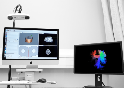 Tractography-guided Neuronavigation