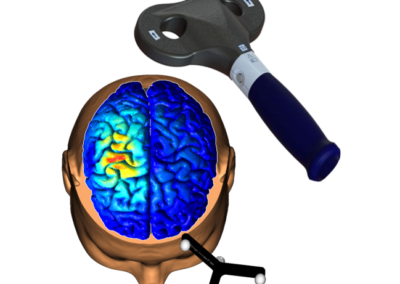 Tutorial: TMS neuronavigation and simNIBS