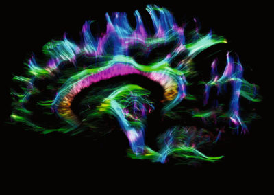 Revisiting the Bounds of Consciousness  Study